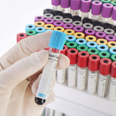 Beli Vacuum EDTA Blood Tubes for Complete Blood Count (CBC) – High Quality, Secure Seal pembuatan online