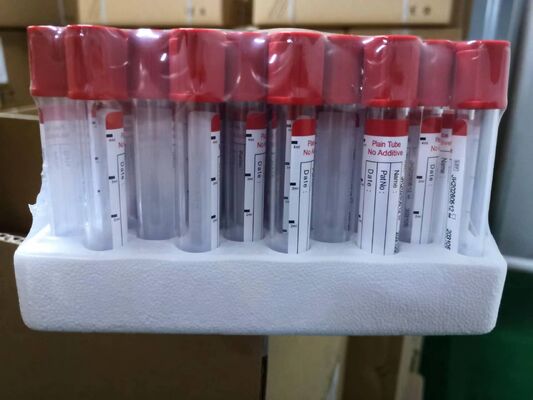 Beli 5 ML Pengumpul darah Paket tabung vakum natrium sitrat 100 pcs. pembuatan online