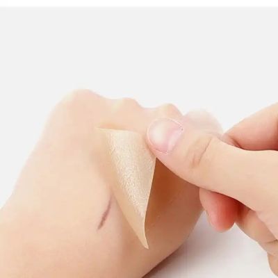 Harga yang pantas Silikon Scar Sheets, Tape, Strip - Healing Keloid, C-Section, Tummy Tuck - Pengobatan Luka Bedah on line
